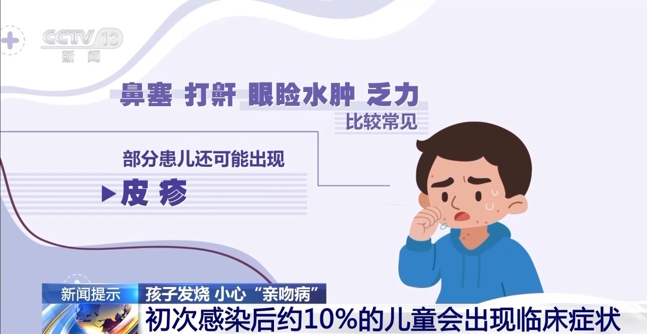 孩子不能又亲又抱 当心“亲吻病”→-第4张图片-便民百事通网