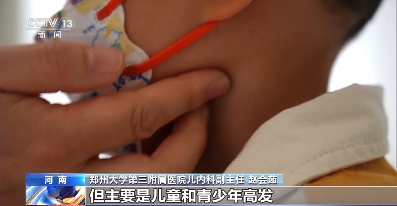 孩子不能又亲又抱 当心“亲吻病”→-第2张图片-便民百事通网